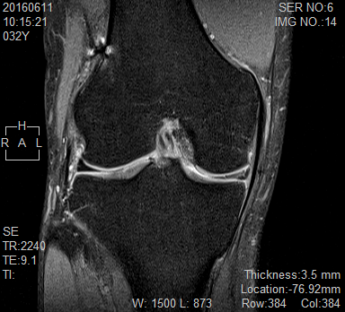 ,p,D,MRI