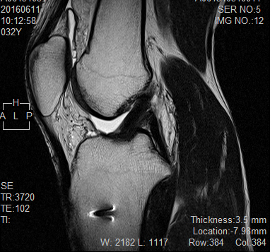 ,MRI,,{g